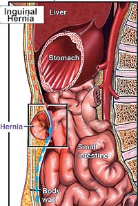 picture of dog hernias picture of dog hernias