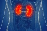 Kidney Cancer