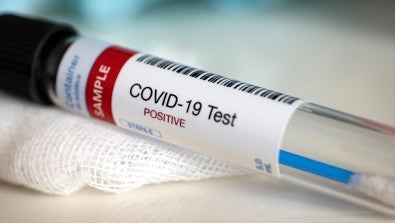 COVID-19 Test