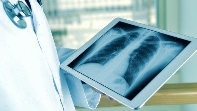 Get the facts about lung cancer at Lehigh Valley Health Network’s upcoming virtual education session.