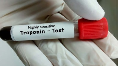 Highly Sensitive Troponin