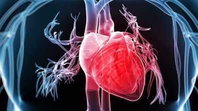 Hypertrophic cardiomyopathy 