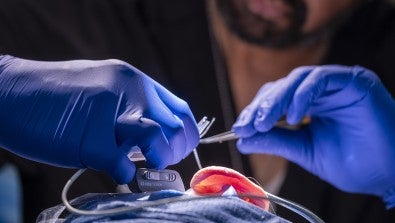 Robotic Cochlear Implant Insertion