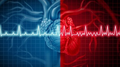 Pulsed field ablation (PFA) uses electrical fields, instead of extreme temps, to target irregular heartbeat
