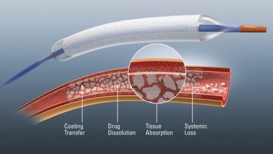 Lehigh Valley Health Network Only in Region to Participate in Drug Coated Balloon Clinical Trial