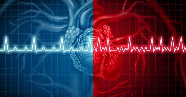 Pulsed field ablation (PFA) uses electrical fields, instead of extreme temps, to target irregular heartbeat